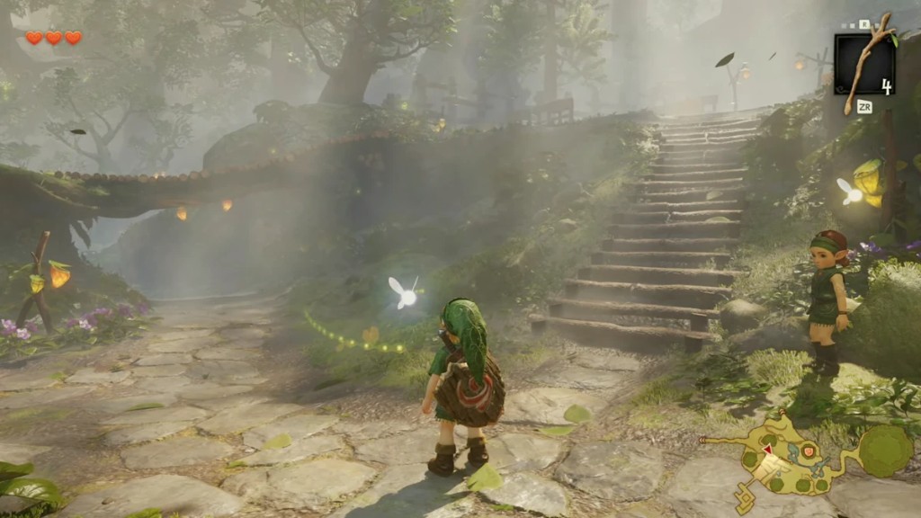 Gameplay del remake en el Bosque Kokiri